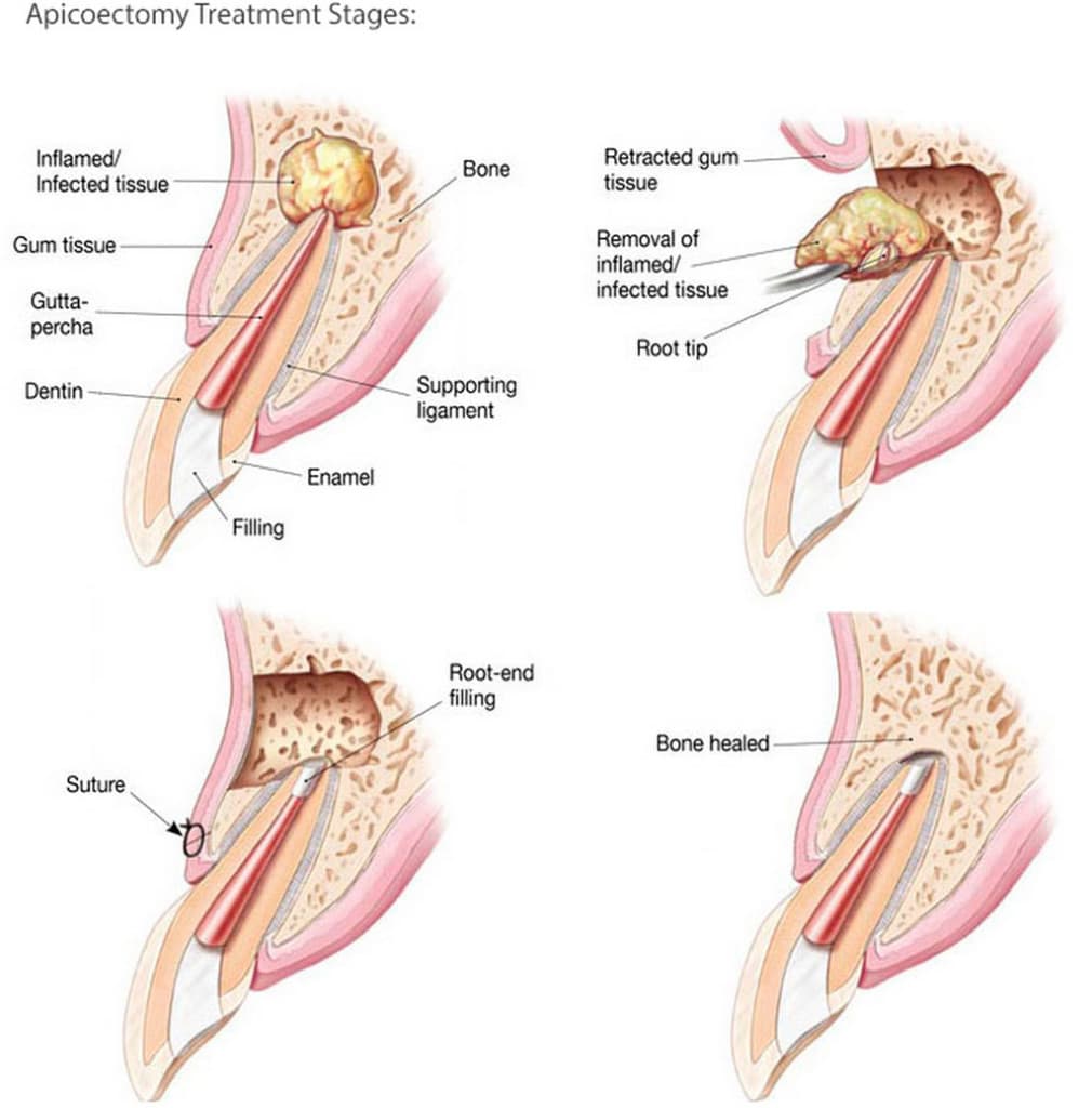 endodontics