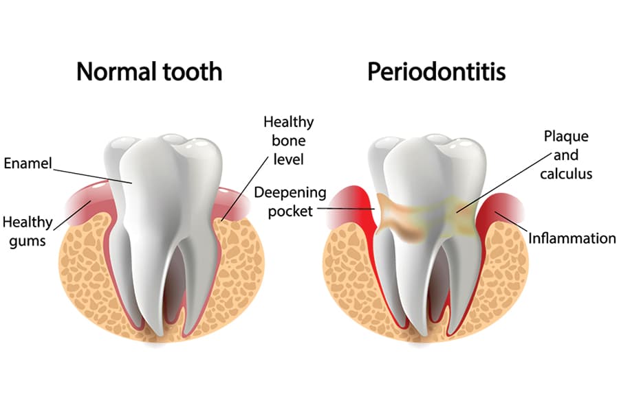 periodontist